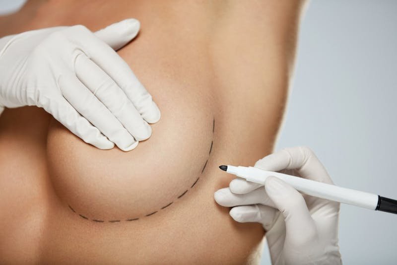 Implant Texture Matters